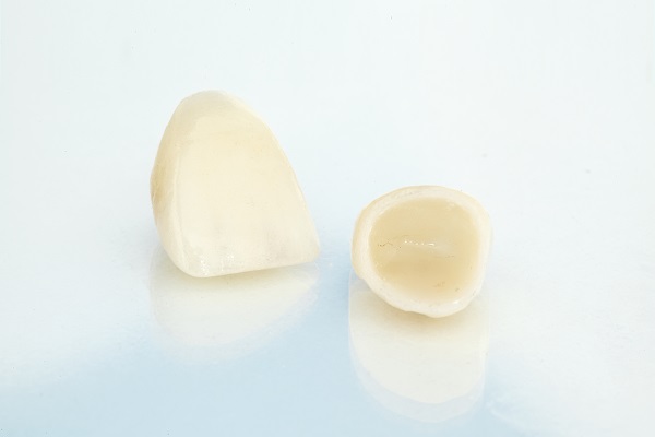 Dental Crown Placement After A Root Canal