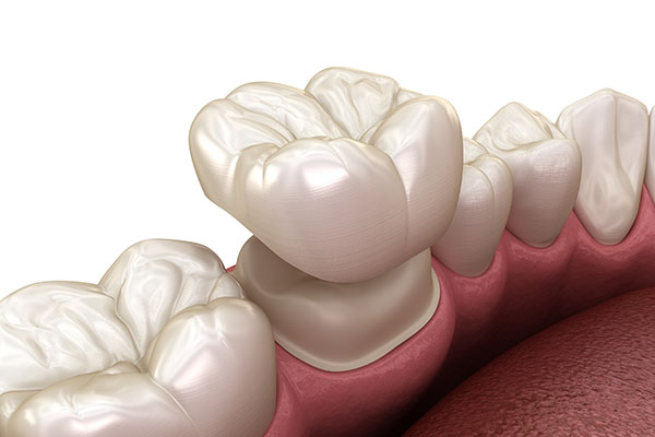 What Can Dental Crowns Do for Your Oral Health Issues? from Lincroft Village Dental Care in Lincroft, NJ