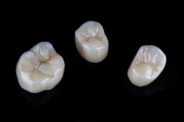 A Comparison of Dental Crown Materials from Lincroft Village Dental Care in Lincroft, NJ