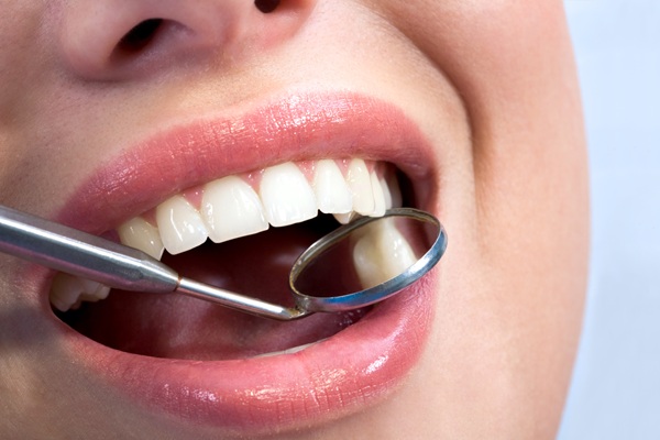 Things To Avoid After Getting A Dental Filling