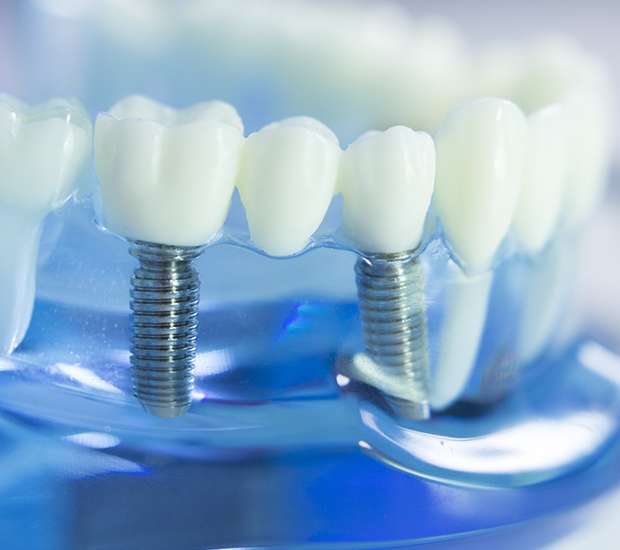 Lincroft Dental Implants