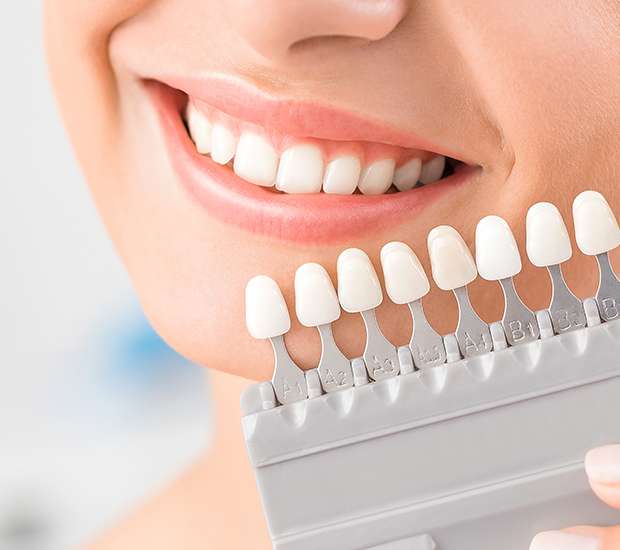 Lincroft Veneers
