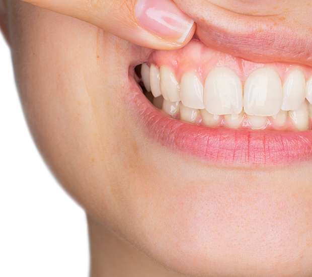 Lincroft Gum Disease