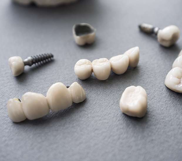 Lincroft The Difference Between Dental Implants and Mini Dental Implants