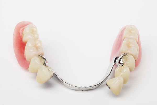 The Importance Of Partial Dentures
