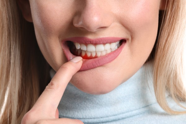 Does Periodontal Disease Cause Gum Infections?