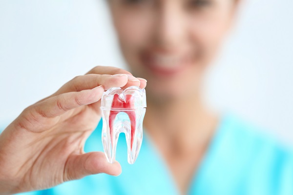 Root Canal Surgery FAQs