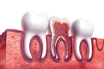 A Root Canal Dentist In Lincroft: Explaining The Basics Of A Root Canal