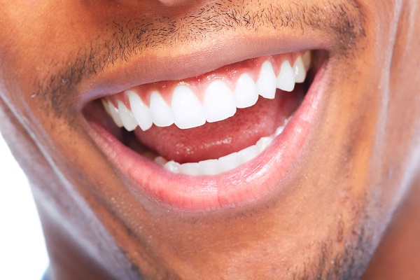 Tips For Choosing A Smile Makeover Procedure