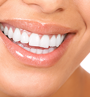 Teeth Whitening Services Lincroft, NJ
